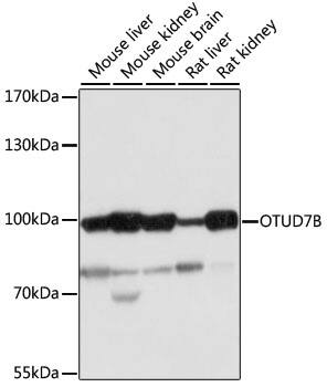OTUD7B/Cezanne/ZA20D1 Antibody