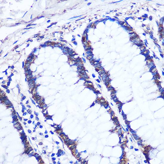 OTUD7B/Cezanne/ZA20D1 Antibody