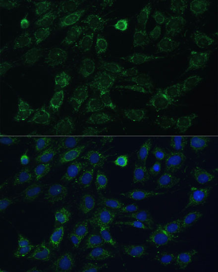 GK2 Antibody