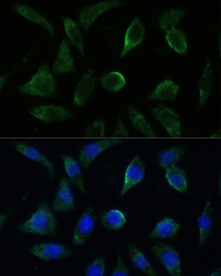 GK2 Antibody