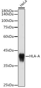 HLA A Antibody