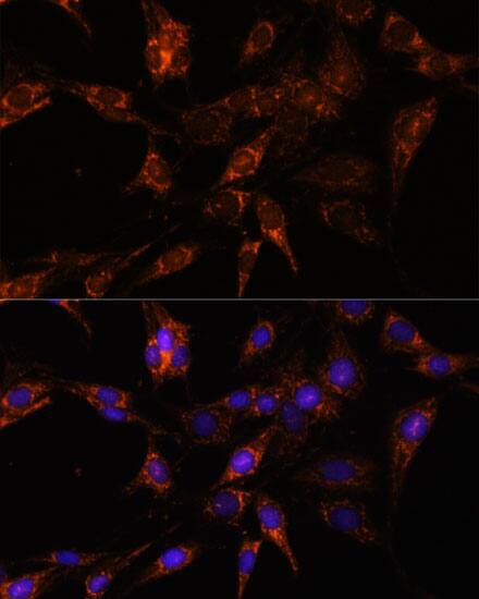 TBCC Antibody