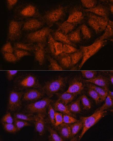 NOB1 Antibody
