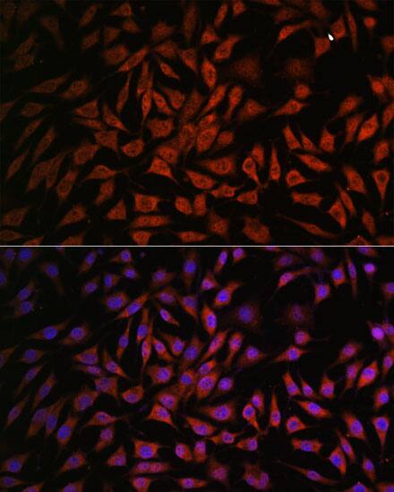 NOB1 Antibody