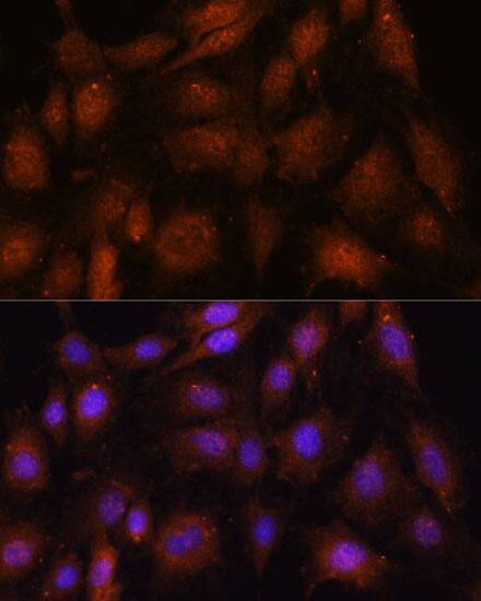 NOB1 Antibody