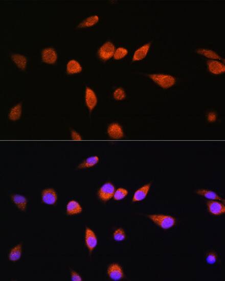 Rab20 Antibody