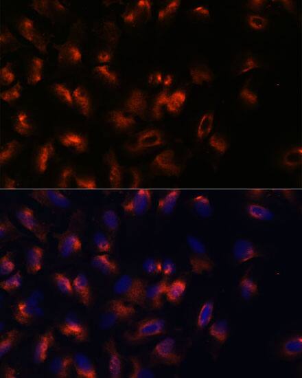 STIM2 Antibody