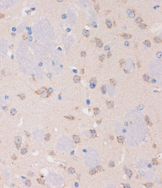 STIM2 Antibody