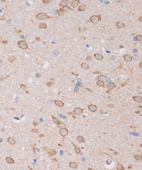 STIM2 Antibody