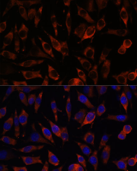 STIM2 Antibody