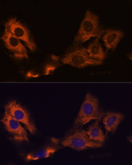 SMAP1 Antibody