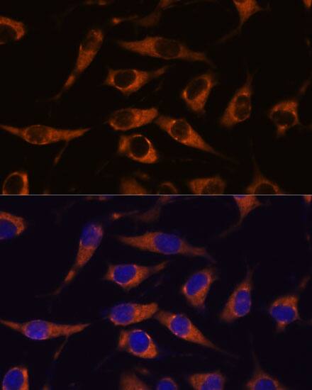 SMAP1 Antibody