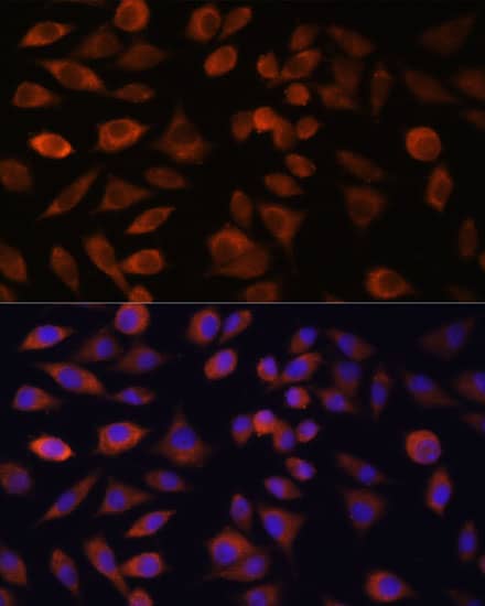 TRIM47 Antibody