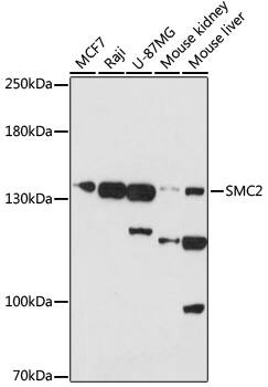 SMC2 Antibody