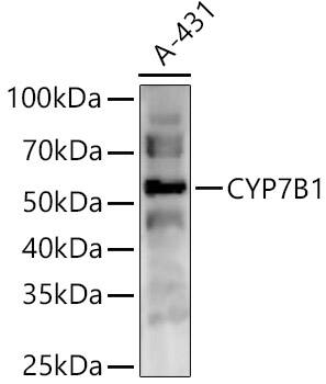 CYP7B1 Antibody
