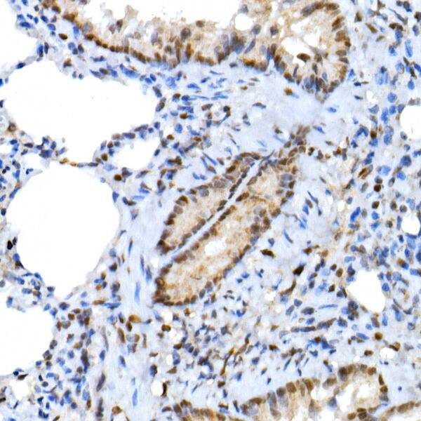 XRCC2 Antibody