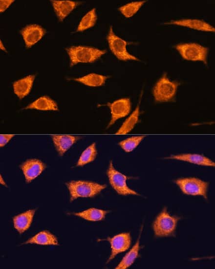 TBC1D4 Antibody