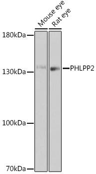 PHLPP2 Antibody