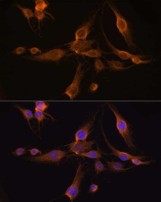 GSTA1 Antibody