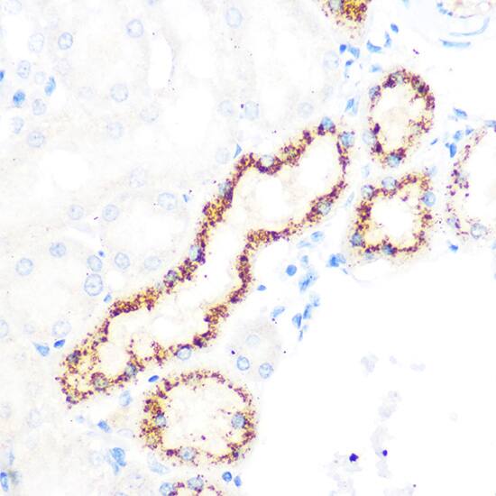 OSR1 Antibody