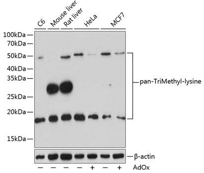 TMLHE Antibody