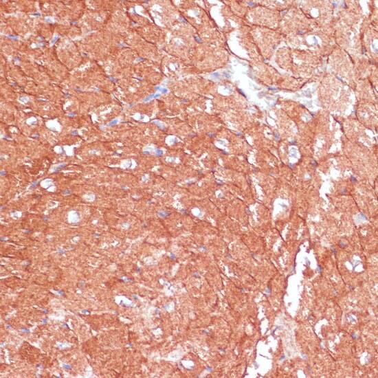 ARHGAP4 Antibody