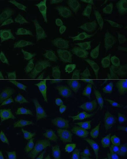 ARHGAP4 Antibody