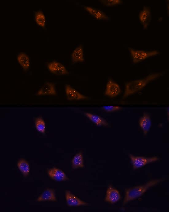 DIP2C Antibody