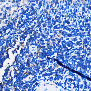 GPR109B/HM74 Antibody