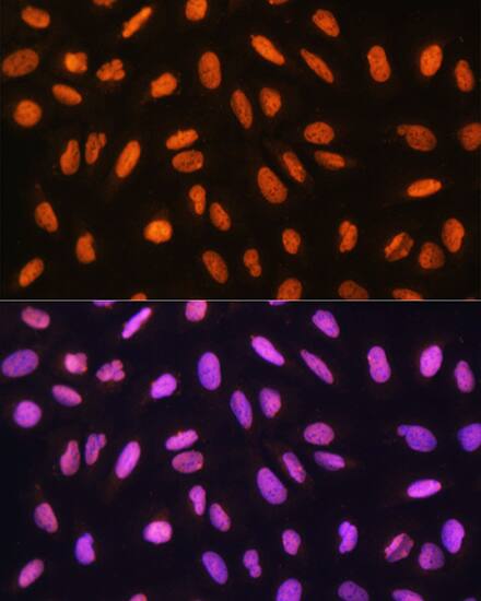 gtf3c3 Antibody