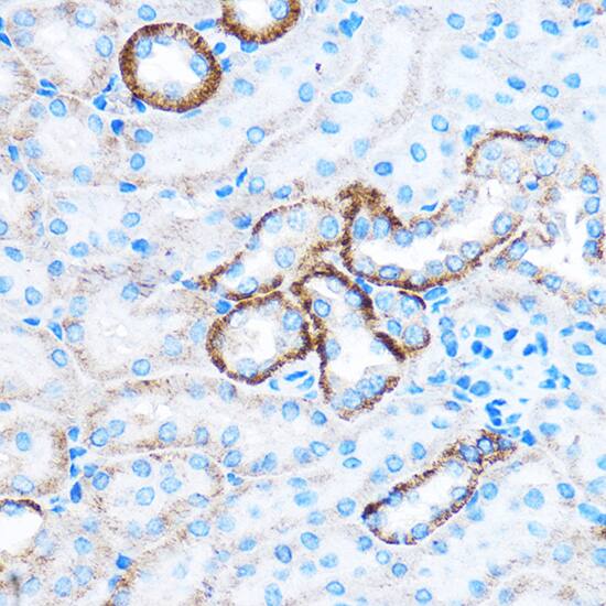 CABP1 Antibody