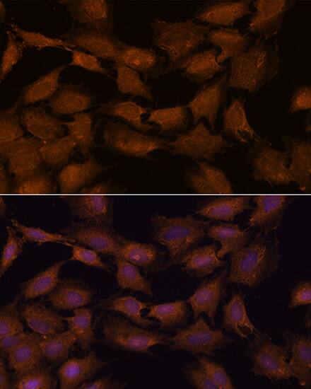 CNAP1 Antibody