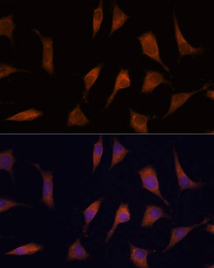 CNAP1 Antibody