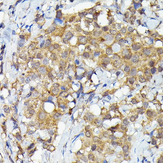 MNK1 Antibody