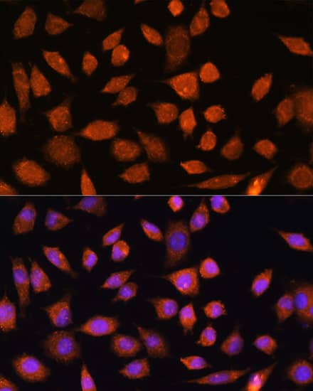 PLD3/Phospholipase D3 Antibody