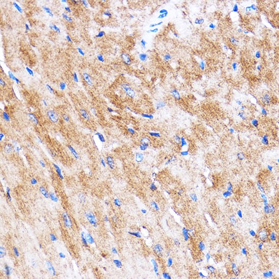 HspB7 Antibody