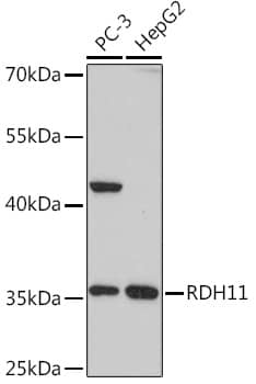 RDH11 Antibody