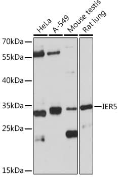 IER5 Antibody