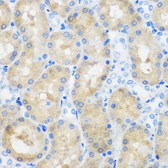 SPOUT1 Antibody