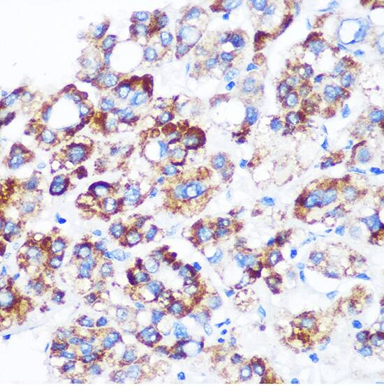 SPOUT1 Antibody