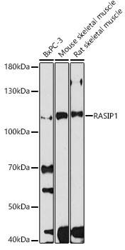 RAIN Antibody