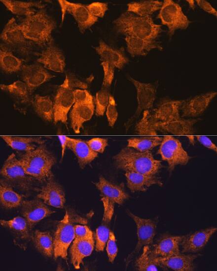 CDV3 Antibody