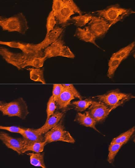 CDV3 Antibody