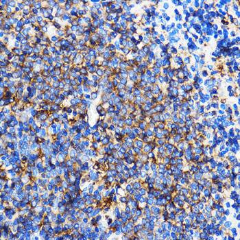 SERINC1 Antibody