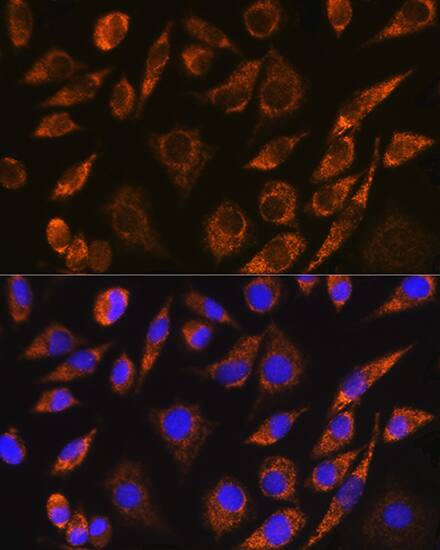 BRUNOL5 Antibody