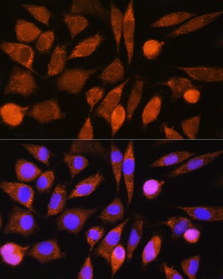 CHCHD7 Antibody