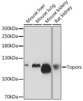 TOPORS Antibody