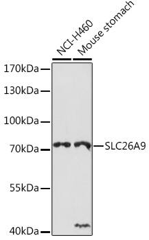 SLC26A9 Antibody