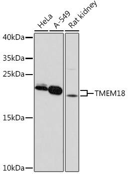 TMEM18 Antibody