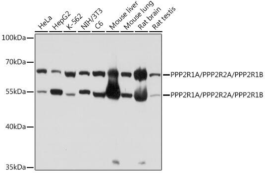 PPP2R1A Antibody